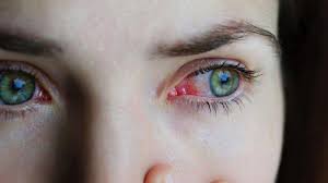 Gangguan Penglihatan