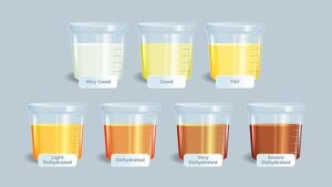 Cara Menjaga Warna Urine Tetap Sehat