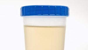 Urine Tidak Berwarna