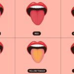 5 Warna Lidah yang Bisa Mengungkap Masalah Kesehatan Tersembunyi