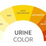 Warna Urine dan Apa yang Diungkapnya Tentang Kesehatan Tubuhmu