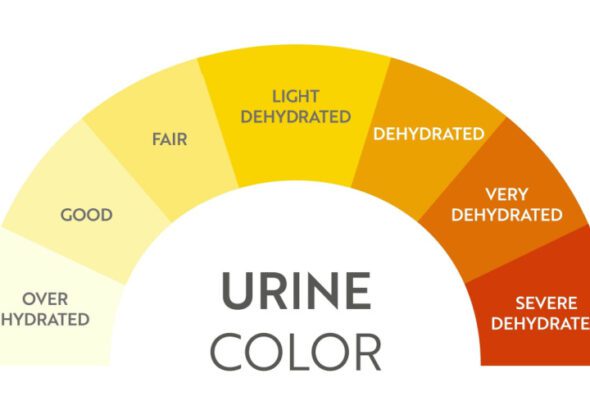 Warna Urine dan Apa yang Diungkapnya Tentang Kesehatan Tubuhmu