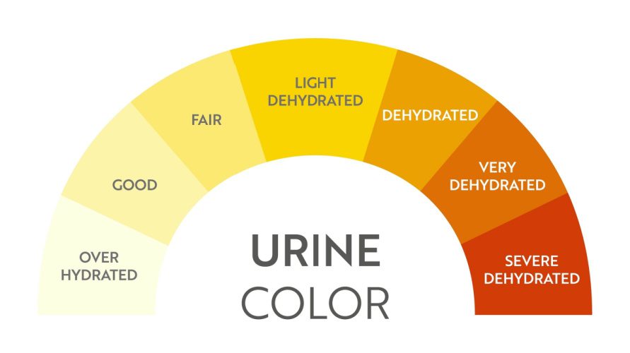Warna Urine dan Apa yang Diungkapnya Tentang Kesehatan Tubuhmu