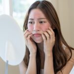 5 Cara Mengatasi Iritasi Kulit