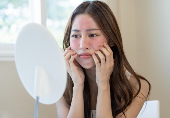 5 Cara Mengatasi Iritasi Kulit