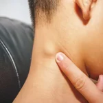 5 Gejala Awal Getah Bening