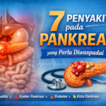 7 Penyakit pada Pankreas yang Perlu Diwaspadai