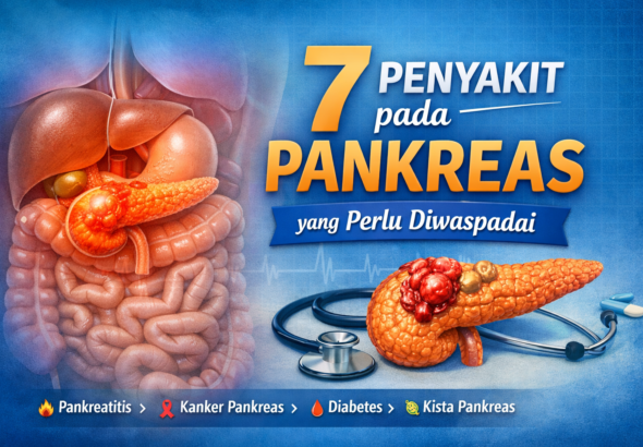 7 Penyakit pada Pankreas yang Perlu Diwaspadai