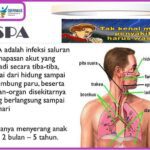 Mengenal ISPA dan 5 Penyebabnya
