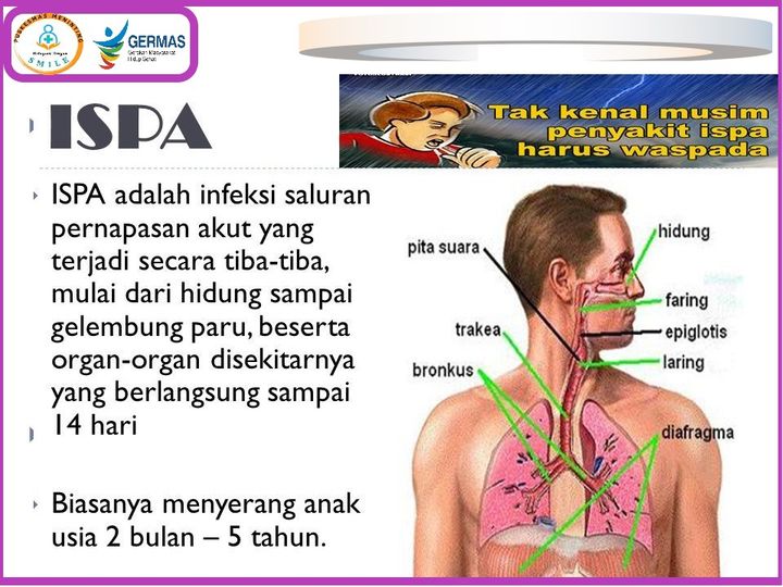 Mengenal ISPA dan 5 Penyebabnya