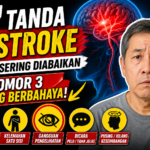 7 Tanda Stroke yang Sering Diabaikan, Nomor 3 Paling Berbahaya