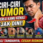 7 Ciri-Ciri Tumor yang Perlu Kamu Kenali Sejak Dini