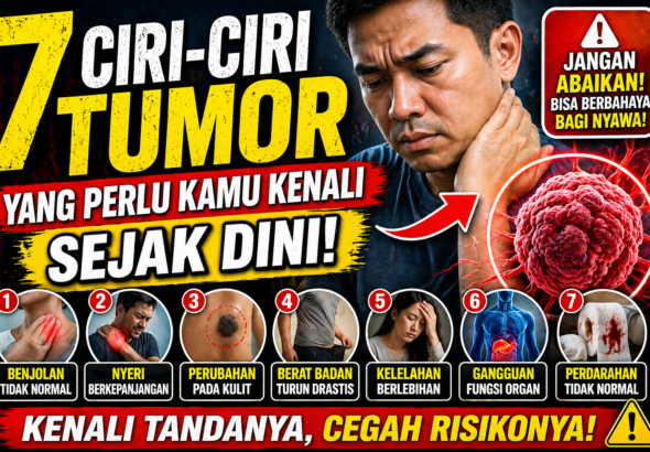 7 Ciri-Ciri Tumor yang Perlu Kamu Kenali Sejak Dini